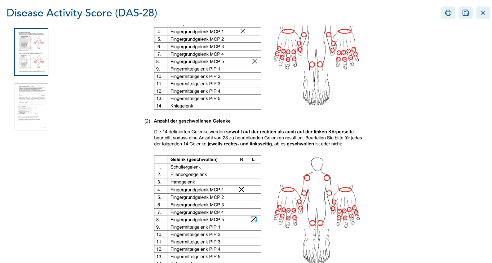 Disease-Activity-Score-Formular Seite 1