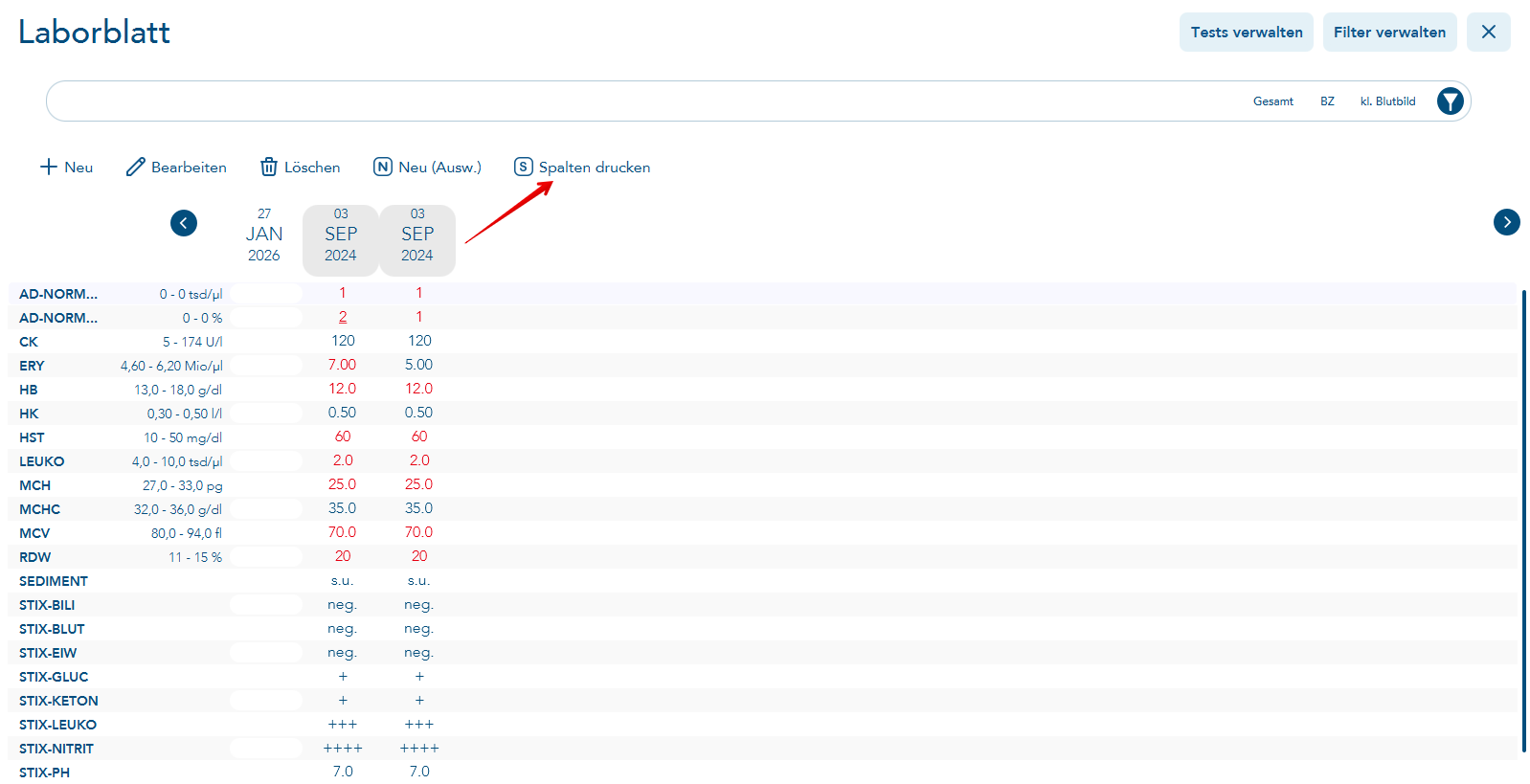 Spalten des Laborblattes drucken